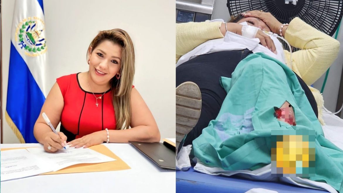 Diputada de ARENA, Rosy Romero, fue atacada por un perro mientras recorría el territorio