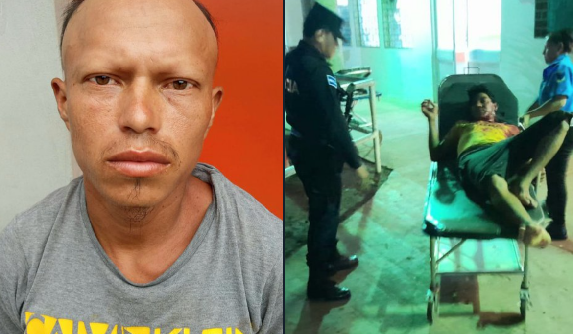Capturan a alias el Pelón responsable de causarle varias lesiones en la cara y el cuerpo a otro sujeto mientras departían en una cervecería