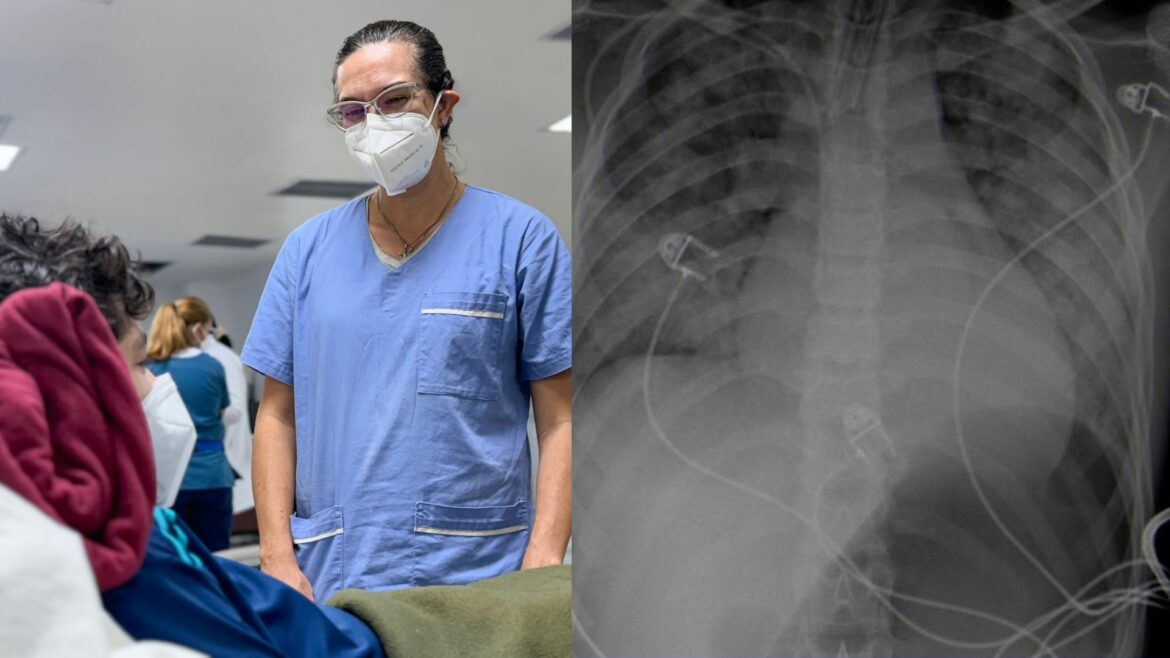 Adolescente sobrevive a una de las picaduras más letales a nivel mundial en el Hospital El Salvador