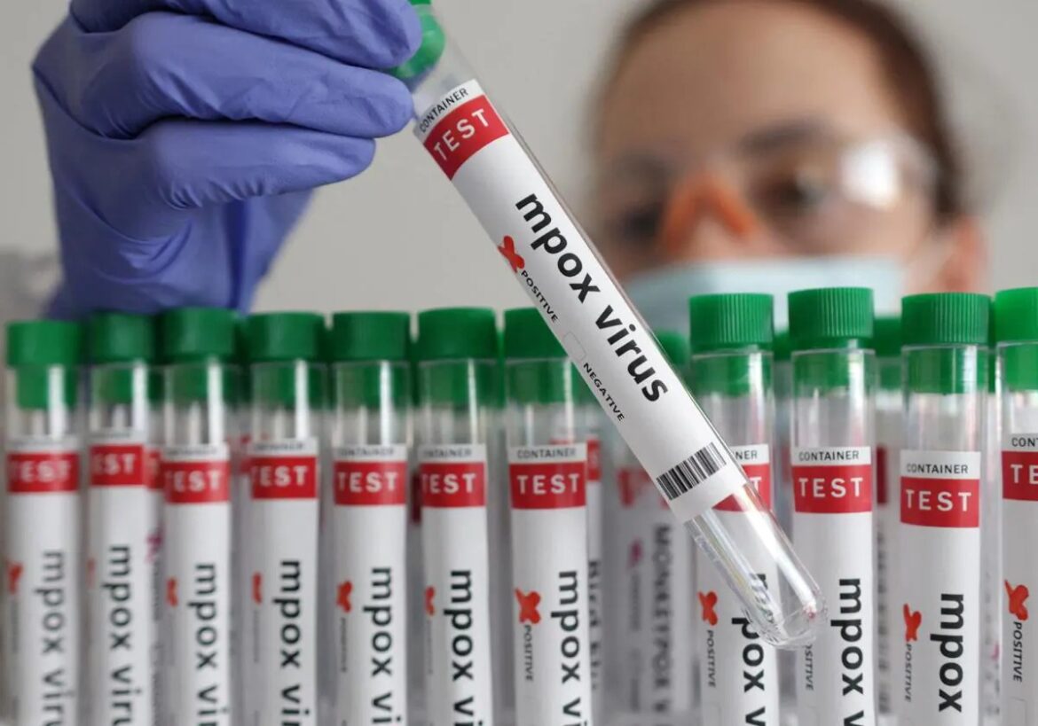 La OMS aprueba el primer test para diagnosticar la mpox