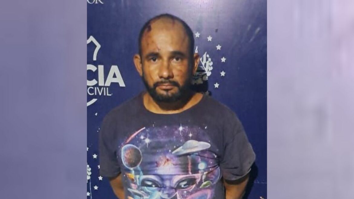 Policía intervino en una discusión de pareja y el hombre lo atacó con un envase de vidrio