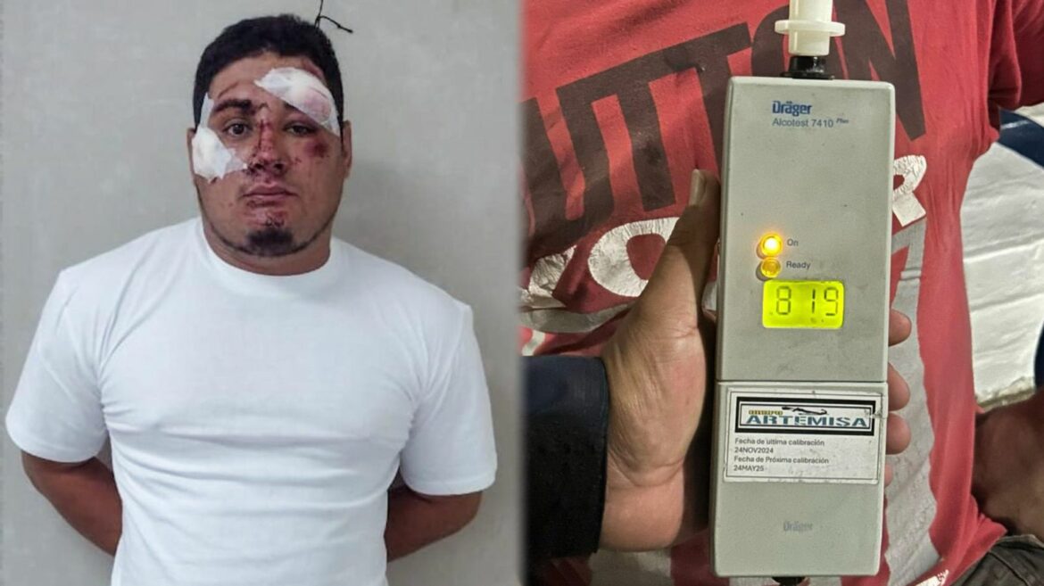 Detienen a sujeto por atropellar a una persona mientras conducía con 819° grados de alcohol