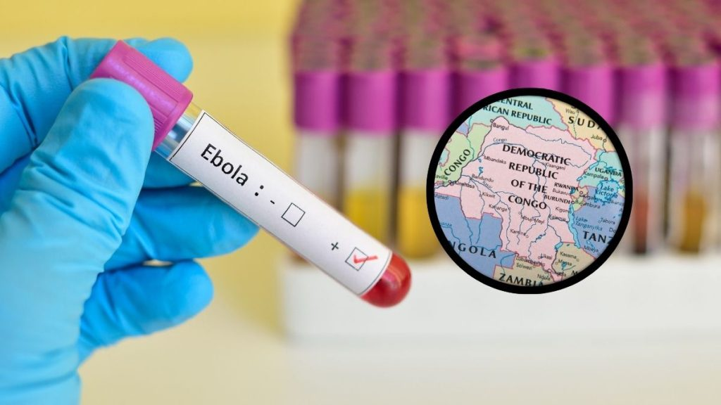Brote de ébola en República Democrática del Congo deja 2,642 muertos y más de 5,500 casos